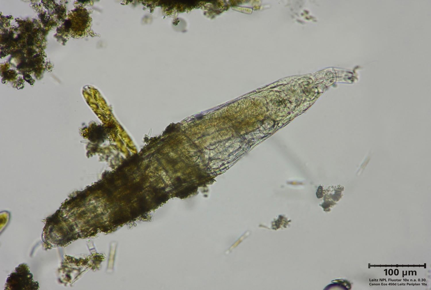 Rotifero da identificare